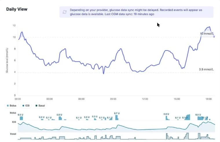 The Enhance-d dashboard Daily View: a day of glucose against bolus, insulin on board and basal